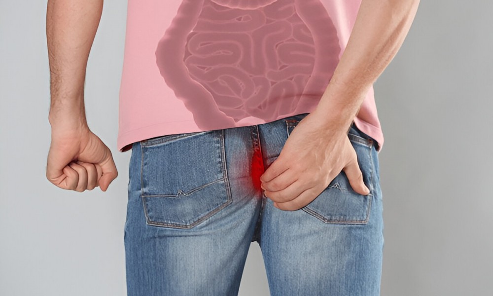 Düzce Proktoloji Kliniği