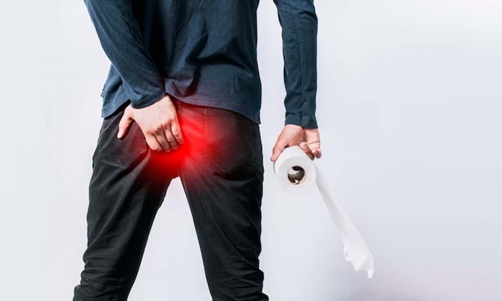 Düzce'de Hemoroid Tedavisi