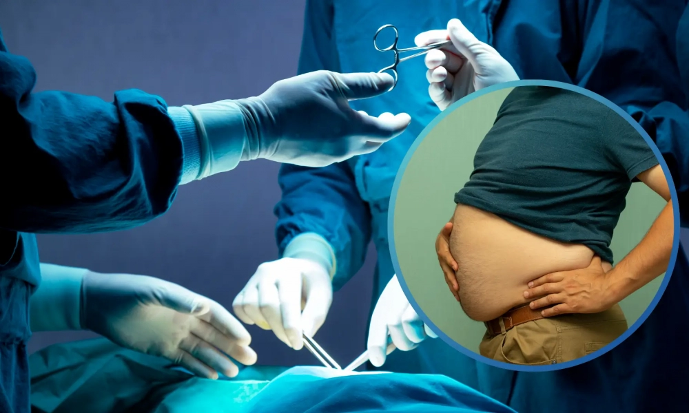 Obezite Cerrahisi